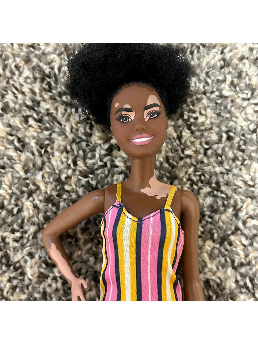 Mattel Barbie Fashion Doll Fashionista #135 Vitiligo Curly Natural Hair Dressed